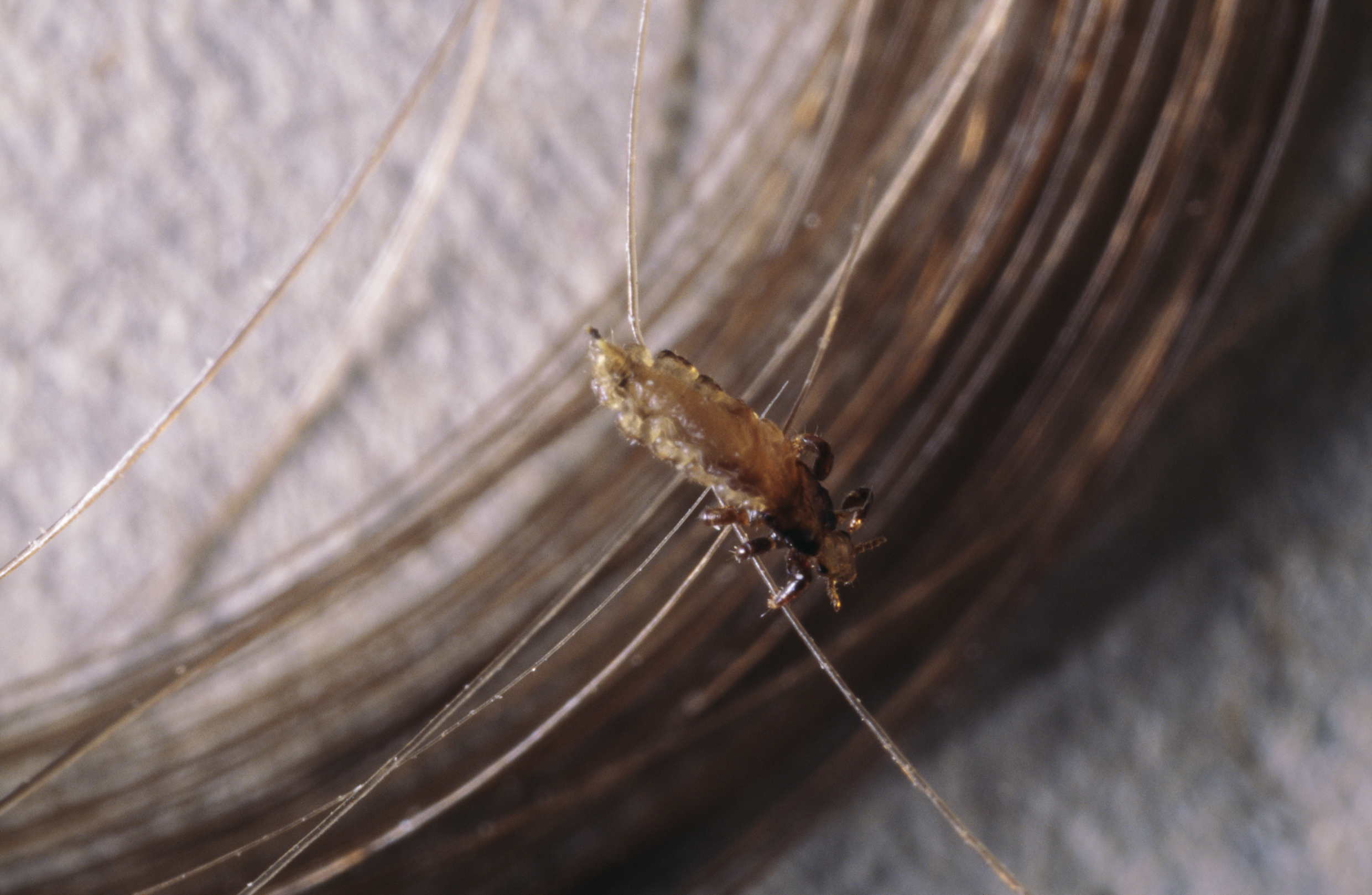 What do head lice look like Symptoms and pictures